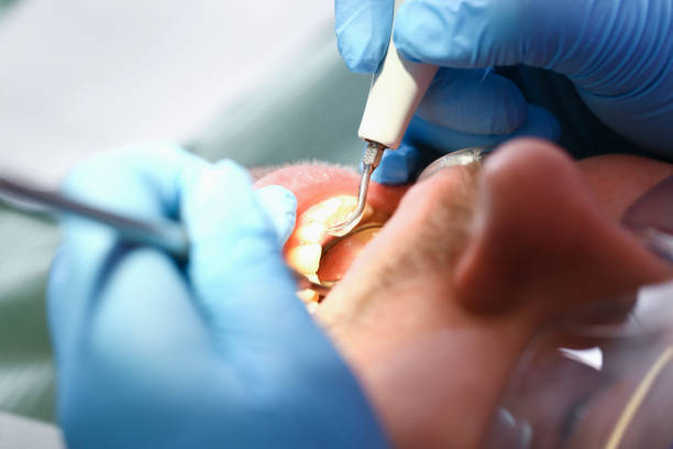 Best Same-Day Emergency Dental Services in Mcdade, TX