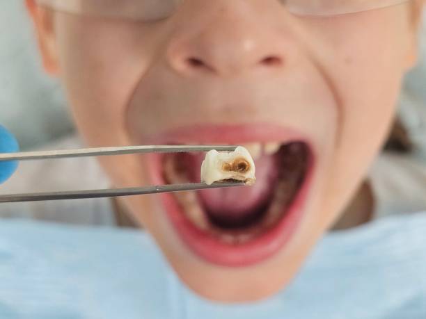 Best Same-Day Emergency Dental Services in Mcdade, TX